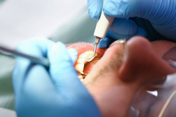 Best Urgent Tooth Repair  in Mill Bay, AK