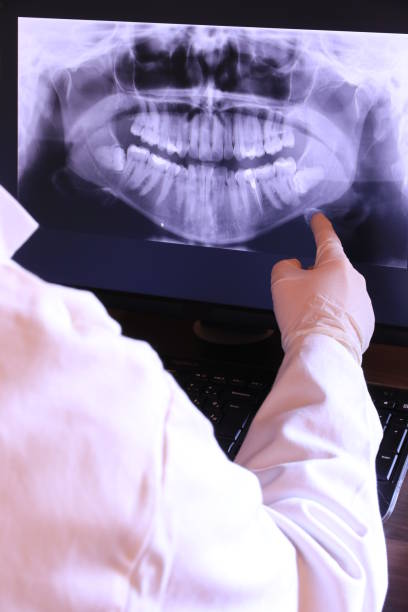 Best Knocked-Out Tooth Emergency  in Mill Bay, AK